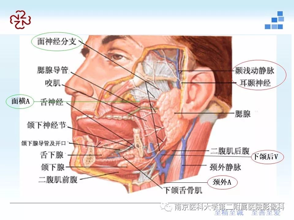 腮腺腺淋巴瘤的影像学表现