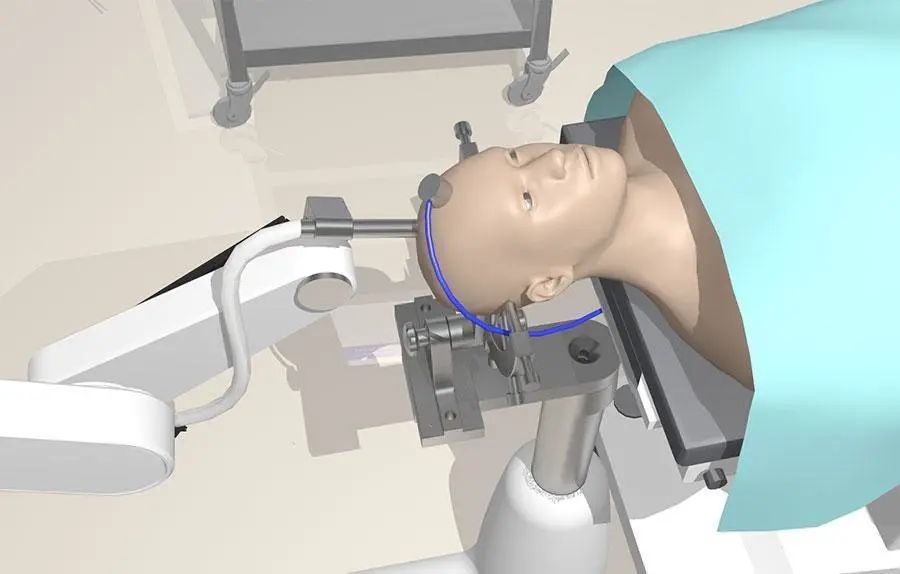 为机器人神经外科手术提供精确动力
