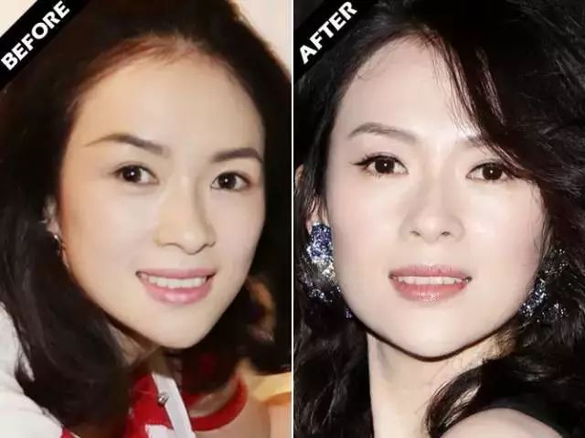 章子怡