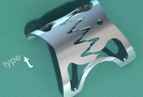 内镜夹怎么不掉CJP每周一帖--OTSC吻合夹系统在经内镜治疗消化道出血、穿孔及瘘中的应用_https://www.jmylbn.com_新闻资讯_第4张