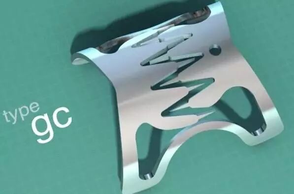 内镜夹怎么不掉CJP每周一帖--OTSC吻合夹系统在经内镜治疗消化道出血、穿孔及瘘中的应用_https://www.jmylbn.com_新闻资讯_第5张