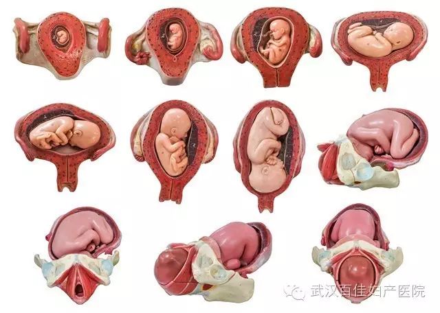 胎位不正虽然以臀位最多见,但横位其实是最最危险的.
