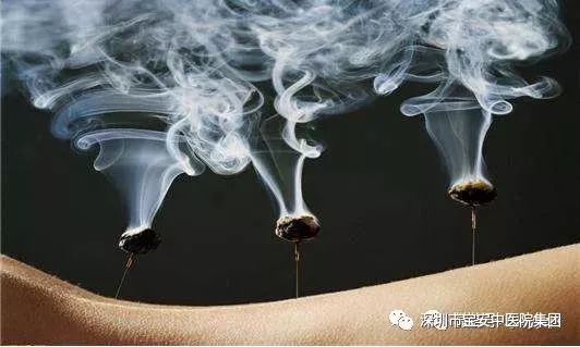 艾灸虽好不要盲目灸,超全艾灸知识大普及!