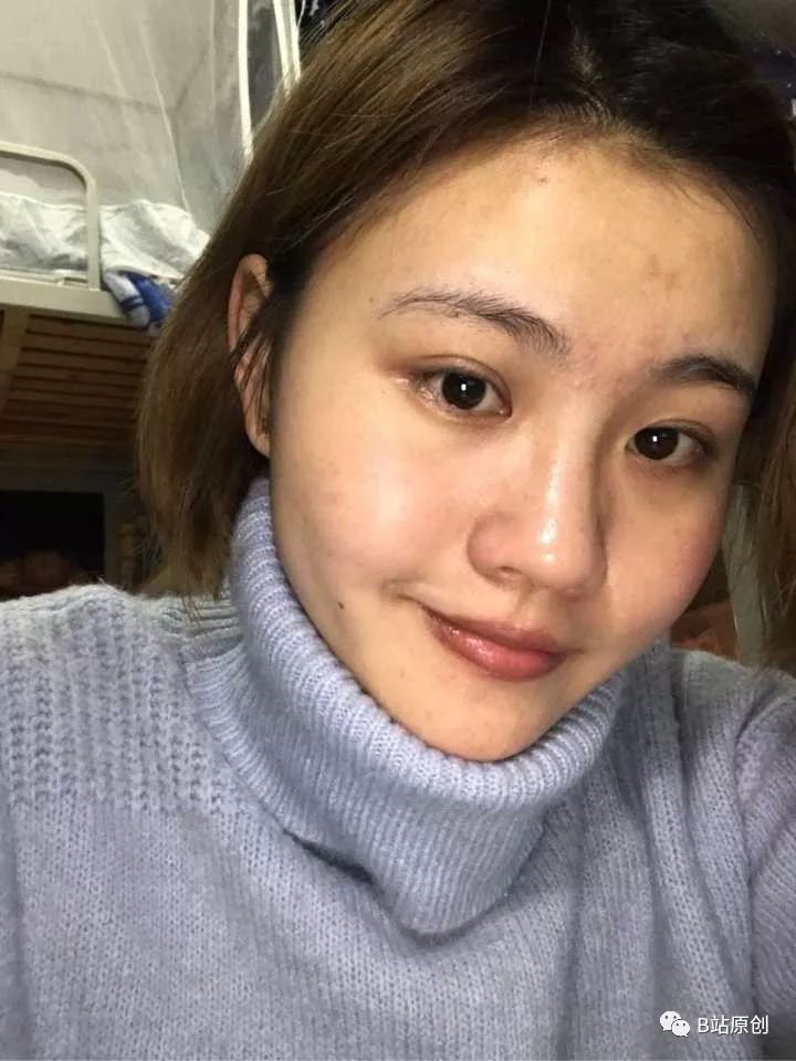 素颜!丑得太真实了hhhh有痘印混油皮有红血丝没错都是我滴皮肤问题!