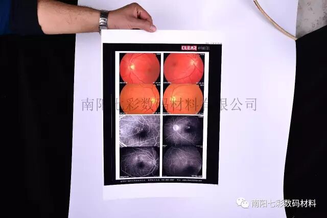 640?wx_fmt=jpeg&tp=webp&wxfrom=5&wx_lazy=1