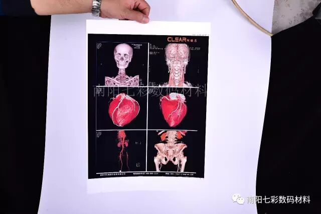 640?wx_fmt=jpeg&tp=webp&wxfrom=5&wx_lazy=1