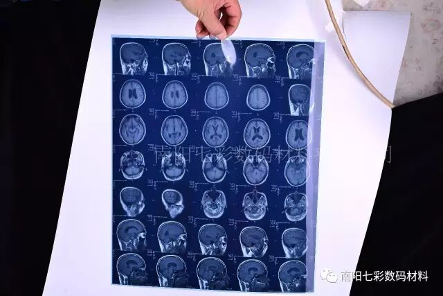 640?wx_fmt=jpeg&tp=webp&wxfrom=5&wx_lazy=1