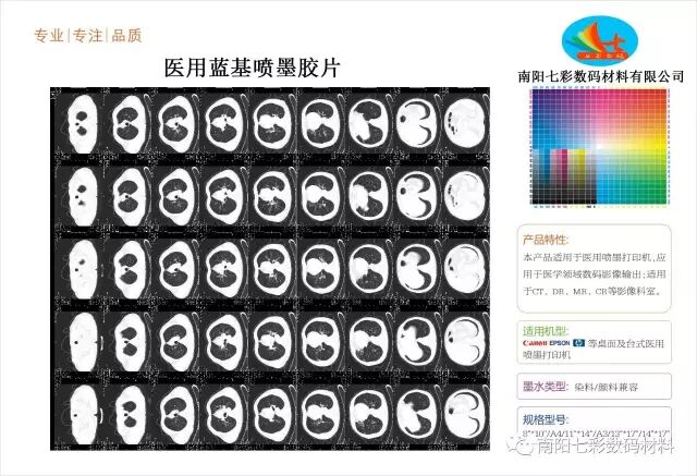 640?wx_fmt=jpeg&tp=webp&wxfrom=5&wx_lazy=1