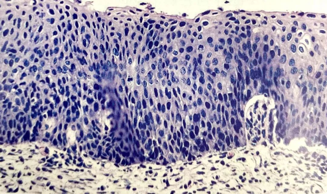 cin2组织学