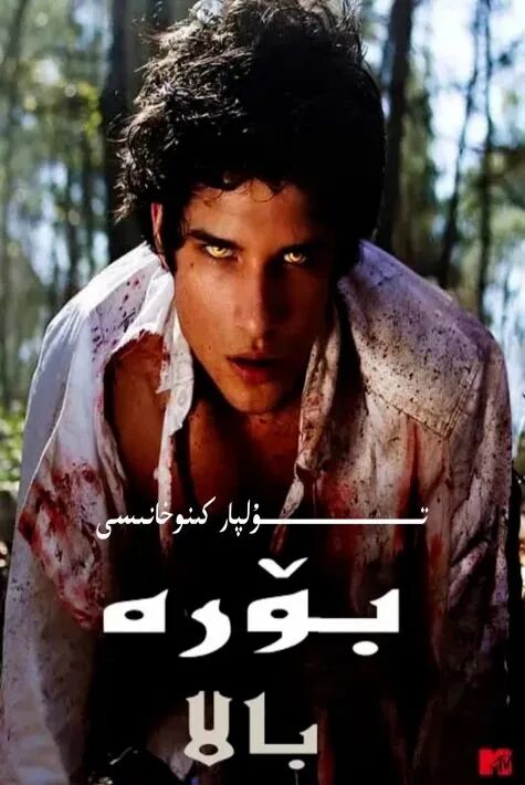 بۆرە بالا 1-بۈلۈم ھەقسىز