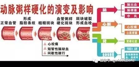 下肢动脉硬化闭塞症的治疗方法有哪些