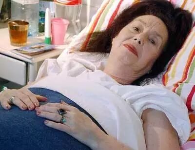 心疼!新生男婴多天未睁眼,医生发现宝宝根本没眼睛!有这些情况怀孕要小心!-怀孕期