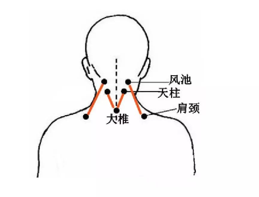 后背的膀胱经为总的排毒通路,无时不在传输邪毒 做后背的刮痧,疏通