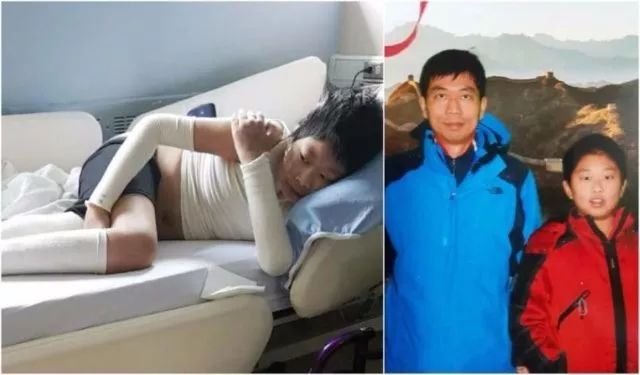 加拿大小心这种病!病因不明,女子半边唇没了