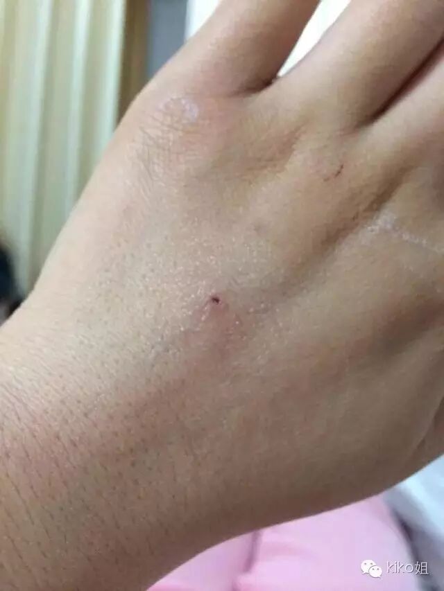 Kiko姐怀孕的细碎念2-记录红房子住院的孕晚期A-怀孕期