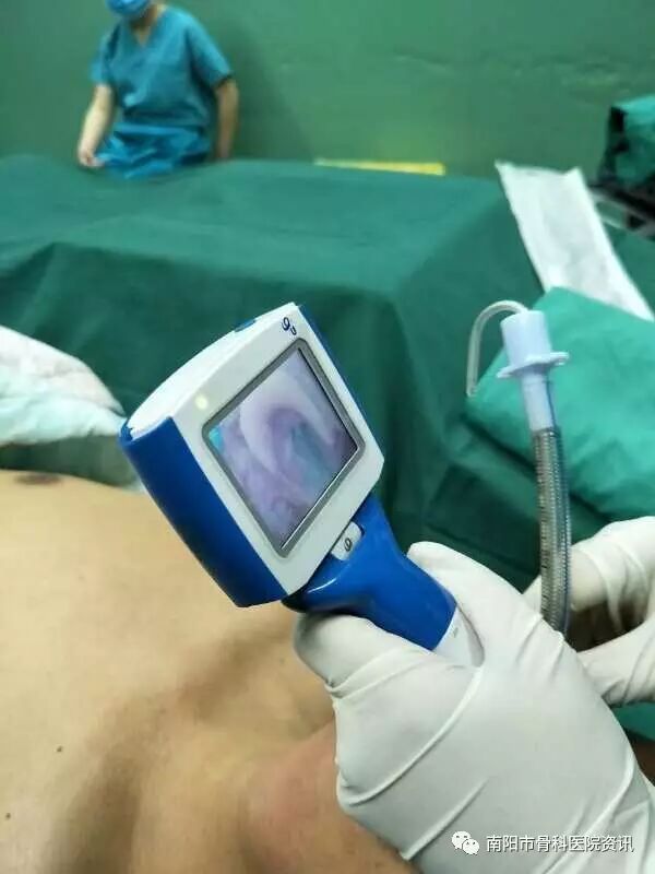 为什么购买可视硬性喉镜麻醉医生的“得力助手”——可视喉镜_https://www.jmylbn.com_新闻资讯_第6张