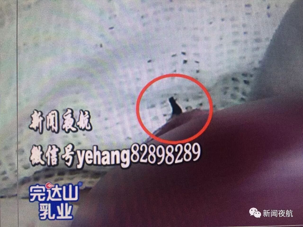 黑龙江3岁女孩囫囵吞枣 枣核尖儿刺入肠壁