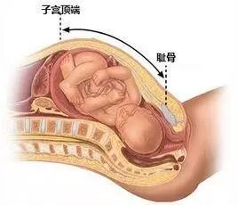 腰酸背痛?大腿痛?走路翻身都痛?!怀孕开始就到处痛,原因就是它!