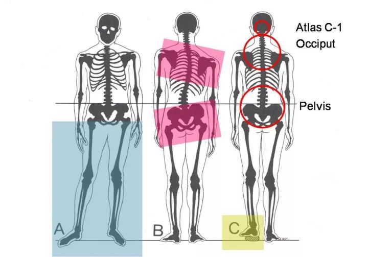 骨盆上下倾斜,该如何自我调整?