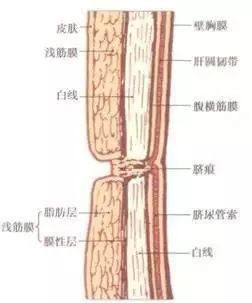 人需要清理肚脐吗?