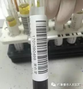 西门子生化是什么我院Aptio德国西门子自动化检验流水线正式投入使用_https://www.jmylbn.com_新闻资讯_第6张