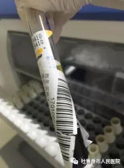 西门子生化是什么我院Aptio德国西门子自动化检验流水线正式投入使用_https://www.jmylbn.com_新闻资讯_第5张