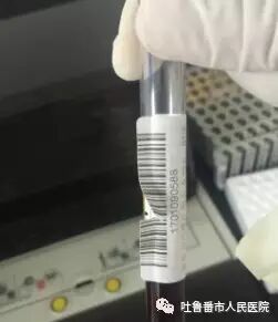 西门子生化是什么我院Aptio德国西门子自动化检验流水线正式投入使用_https://www.jmylbn.com_新闻资讯_第4张