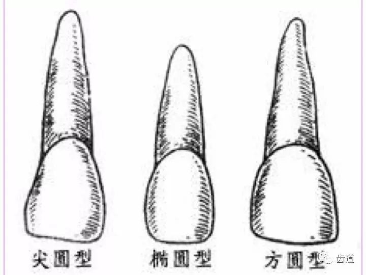 一颗牙的解剖上颌中切牙解剖形态特征