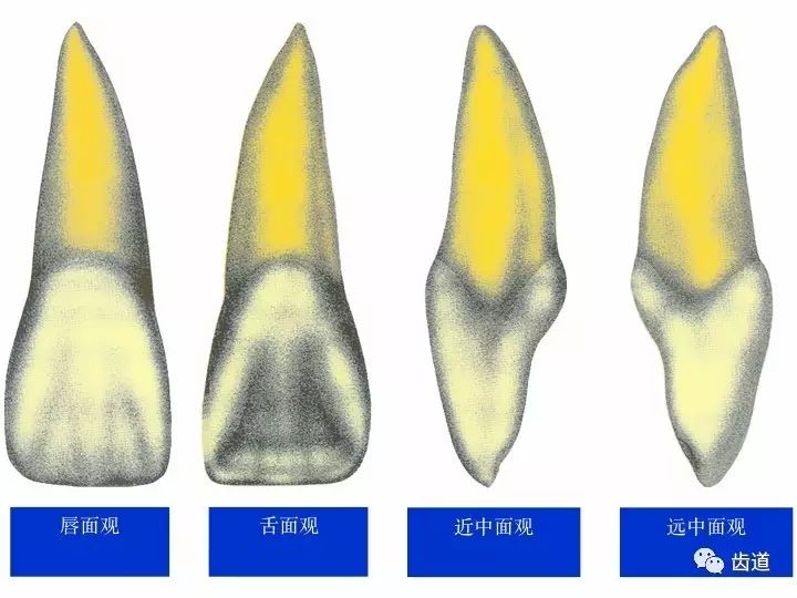 一颗牙的解剖上颌中切牙解剖形态特征