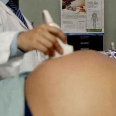 【欧浪网】近月第四例！28岁孕妇剖腹产后死亡  孕妇感染后变重症的风险极高