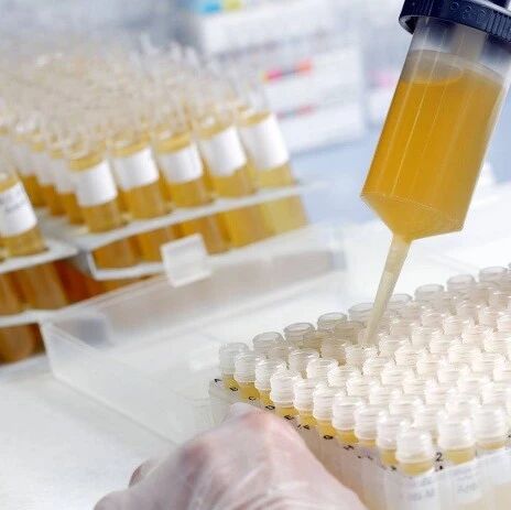 【欧浪网】好消息！加泰药厂研发出新冠治疗药  开始临床试验