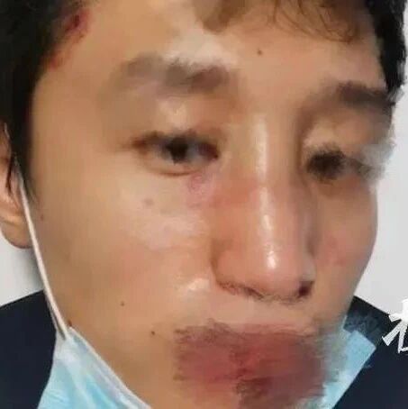 【欧浪】多名中国留学生遇袭，有女生被钝器砸头！我使领馆紧急提醒