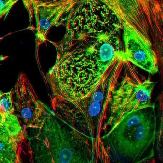 【欧浪网】西班牙发现更多新毒株  美国变种可显著提高传染和避过疫苗