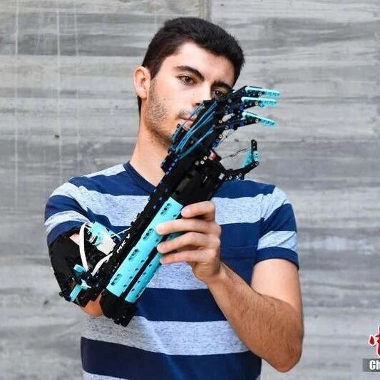 【欧浪网】脑洞大开!西班牙小伙用乐高打造“仿生”假肢