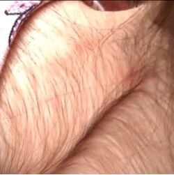 【欧浪网】奇闻！西班牙医生错用生发药物导致20个孩子变“毛孩”