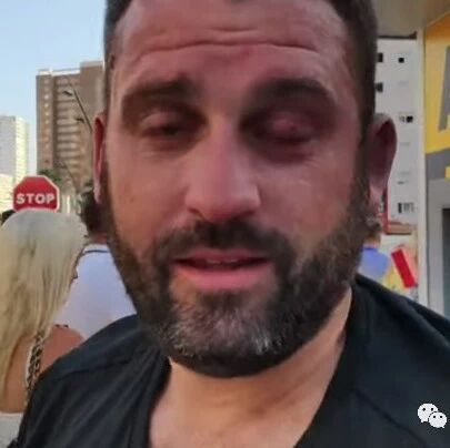 【欧浪网】来西度假等于花钱找虐？ 一游客在Benidorm街头被暴打