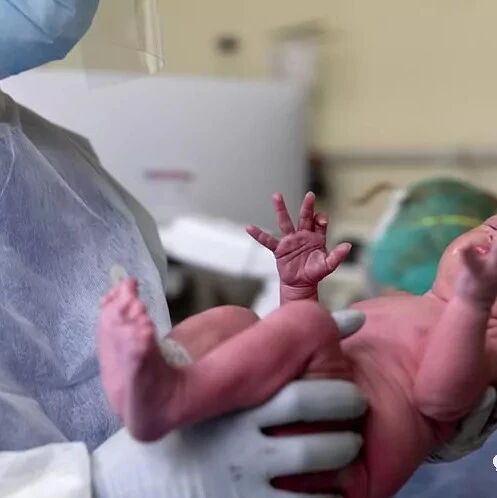 【欧浪网】670个母亲感染冠状病毒情况下生育 40名新生婴儿感染​