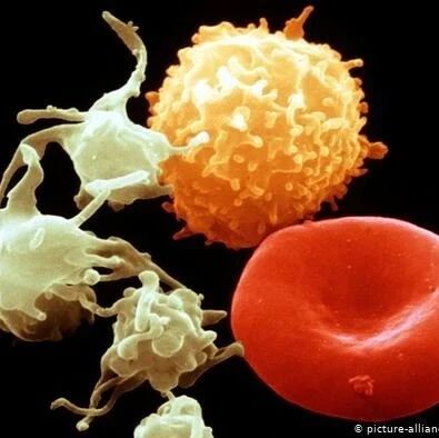 【欧浪网】新冠后遗症从何而来？科学家或找到原因