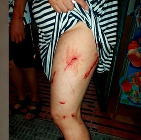 【欧浪网】 马德里华人食品店业主被歹徒打伤 担心报复未报警