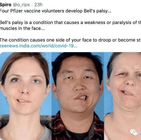 【欧浪网】辉瑞新冠疫苗又出事：13人接种后“罕见”面瘫