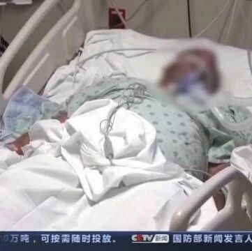 【欧浪网】美国48州新增确诊病例上升 疫苗接种慢为重要原因