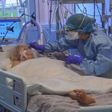 【欧浪网】学者发现新冠重症警示信号