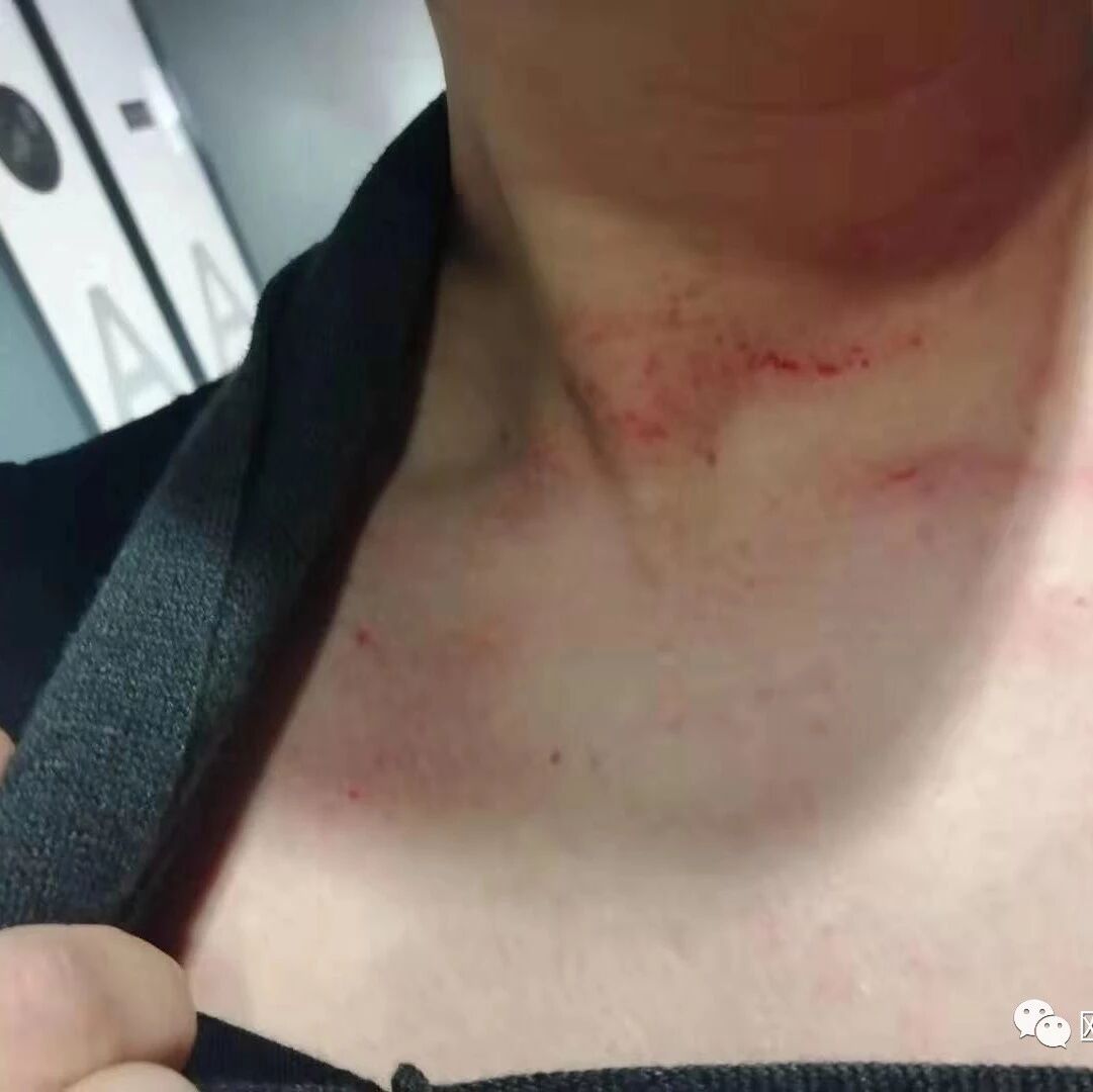 【欧浪网】华人餐厅惨案！ 不上保险还多人暴打员工
