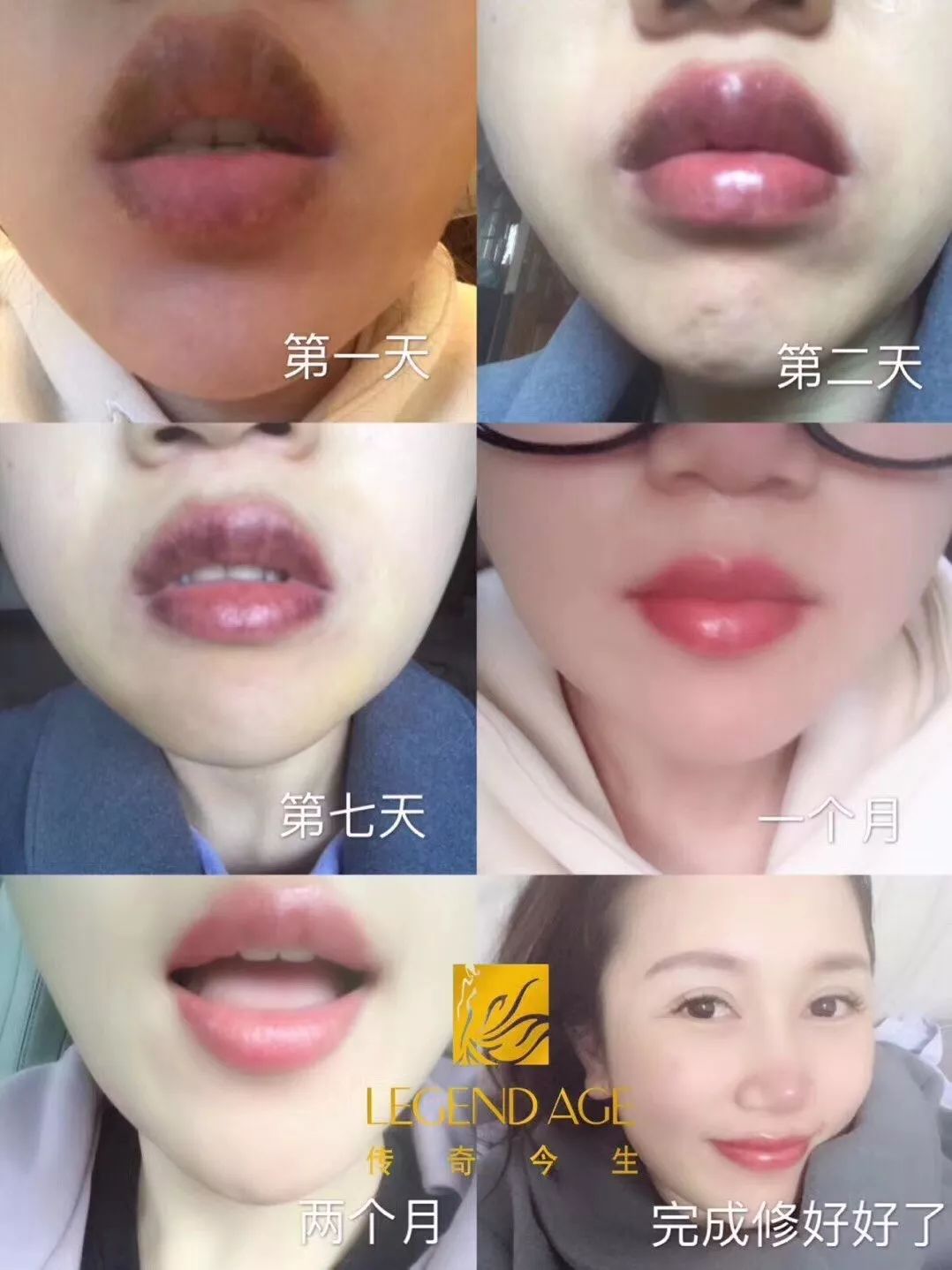 四,唇部有斑