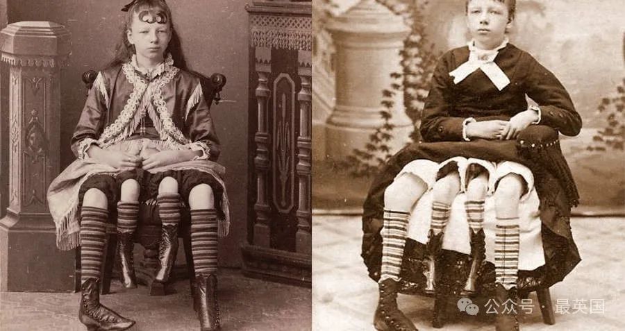 The Story Of Myrtle Corbin, P.T. Barnum's 