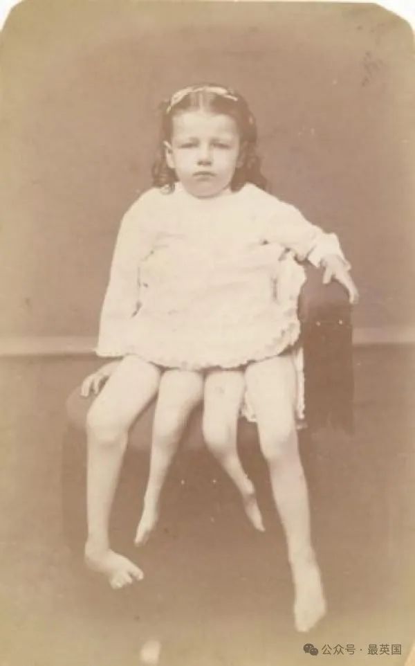 Ella Harper & Myrtle Corbin - More Than a Curiosity — Disability Throughout  History