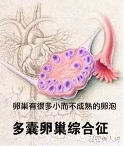 周杰伦老婆搁置“二胎计划”,只因多囊卵巢综合症!-怀孕期