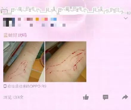 俄罗斯的自杀式死亡游戏,因参与者在社交网络上发布蓝色鲸鱼的图片,或