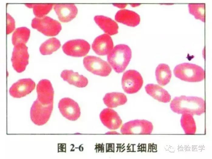 关于提高血液红细胞形态检验技能和诊断能力的几点认识