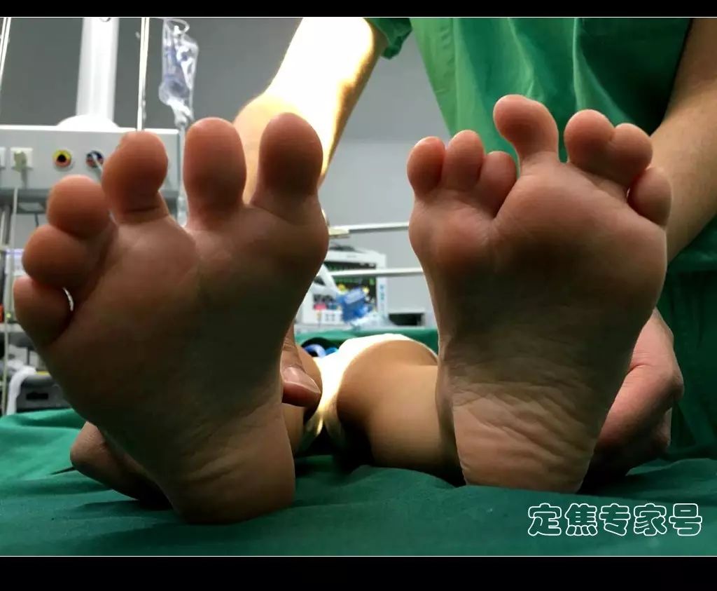 孩子出生就十三根脚趾,罪魁是添加剂,手机,药物,还是病毒?